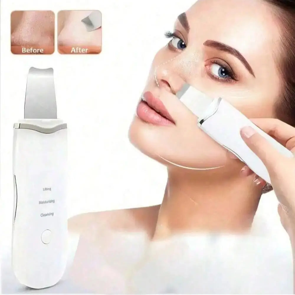Espátula Ultrassônica Facial – Limpeza Profunda e Removedor de Cravos